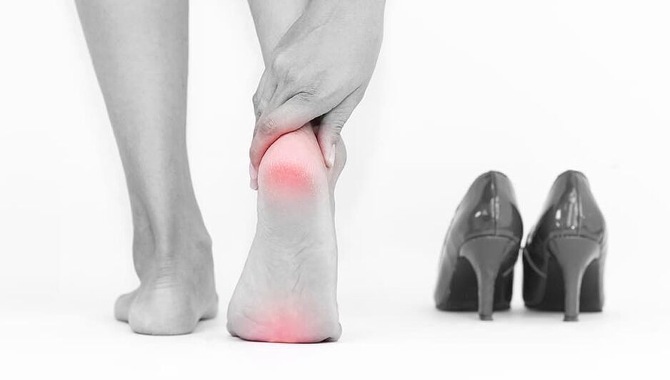 A causa das varices son zapatos incómodos