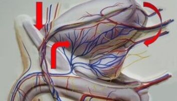 Varices das veas pélvicas