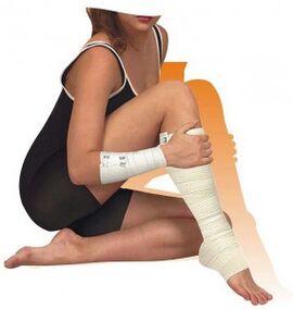 Terapia adicional para varices
